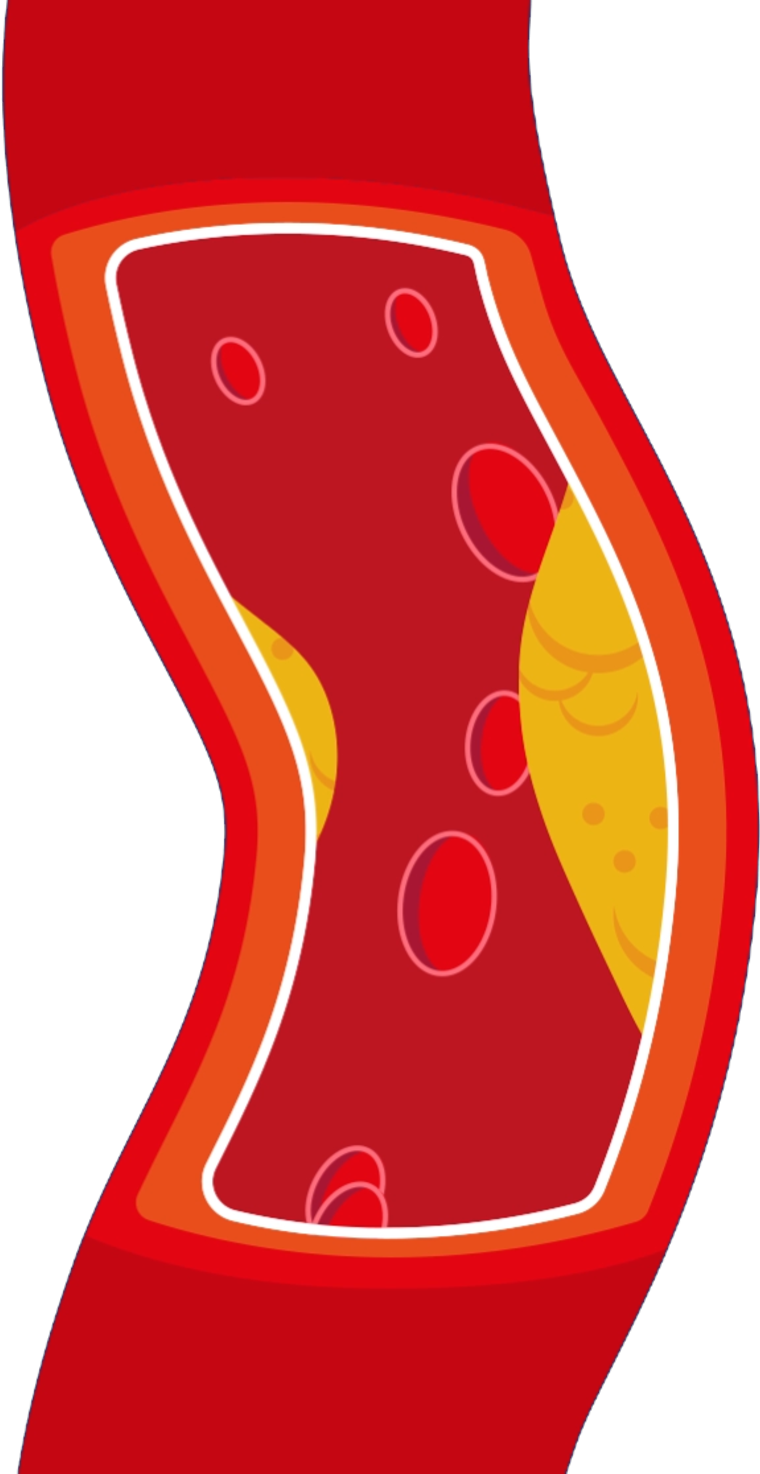 how-to-lower-ldl-bad-cholesterol